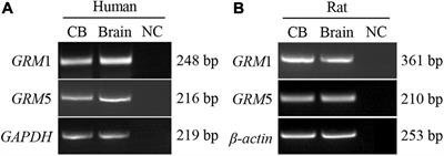 Metabotropic Glutamate Receptors 1 Regulates Rat Carotid Body Response to Acute Hypoxia via Presynaptic Mechanism